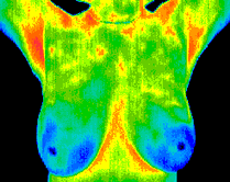 breast1 breast1