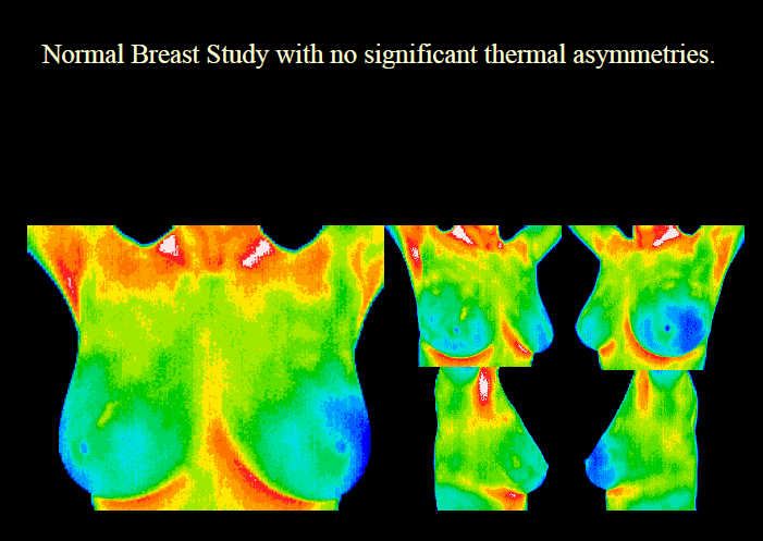 breastscreenprocedure breastscreenprocedure