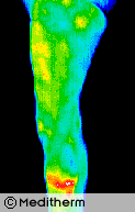 case_3 case_3